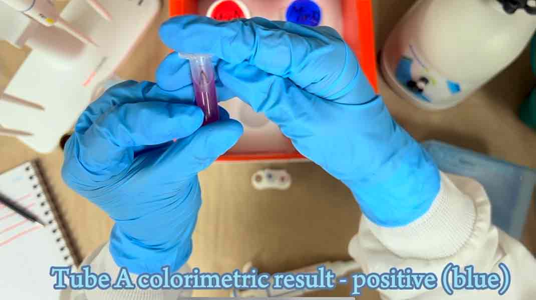 Detectar c&aacute;ncer de mama con dispositivo de bajo costo, proyecto Mi-Biomark.