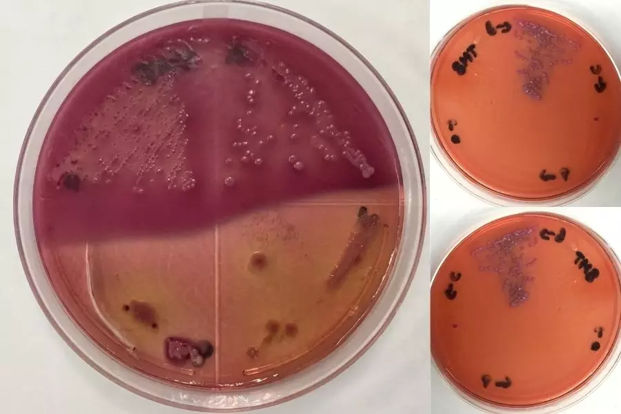 Avances de resultados de cultivo de bacteria "escherichia coli".