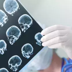 Egresado del Tec de Monterrey desarrolla bisturí inteligente que detecta tumores cerebrales